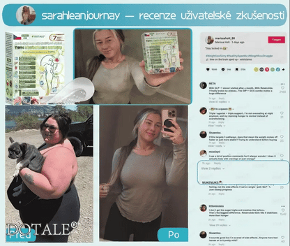 𝑫𝑶𝑻𝑨𝑳𝑬® metabolická nano mikrojehličková náplast 🧑‍⚕️ (Pouze jednou denně, viditelné výsledky již do 7 dnů!) ✅ Formule Berberin + Moringa, ideální při nadváze, nedokonalostech pokožky, diabetu, spánkové apnoe a kloubních potížích 💥💥