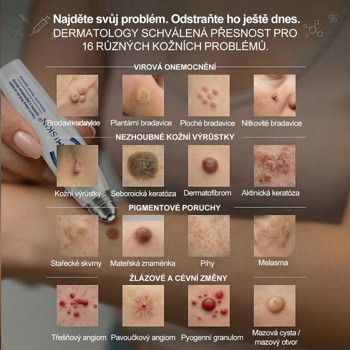 Oficiální značkový obchod | 🐬Hiskin® 7denní odstraňovač skvrn a pigmentových skvrn (Bezbolestný rollerball bez jizev)