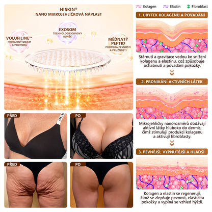HISKIN®🏆 Náplast s nano mikrojehličkami pro objem, pozvednutí a zpevnění poprsí Volufiline + Exosome + Copper Peptide formule poháněná technologií buněčné obnovy