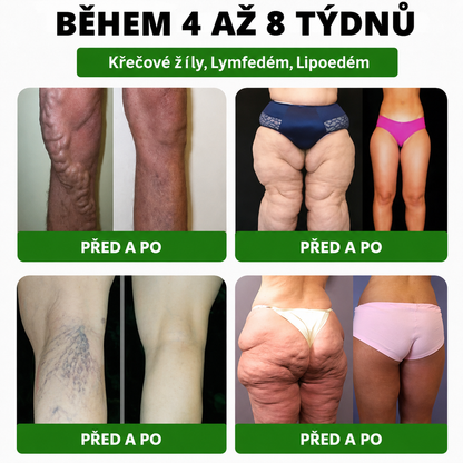 𝑫𝑶𝑻𝑨𝑳𝑬® metabolická nano mikrojehličková náplast 🧑‍⚕️ (Pouze jednou denně, viditelné výsledky již do 7 dnů!) ✅ Formule Berberin + Moringa, ideální při nadváze, nedokonalostech pokožky, diabetu, spánkové apnoe a kloubních potížích 💥💥